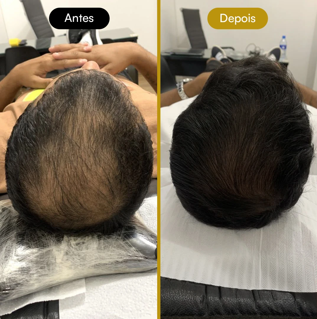 Antes e Depois 01