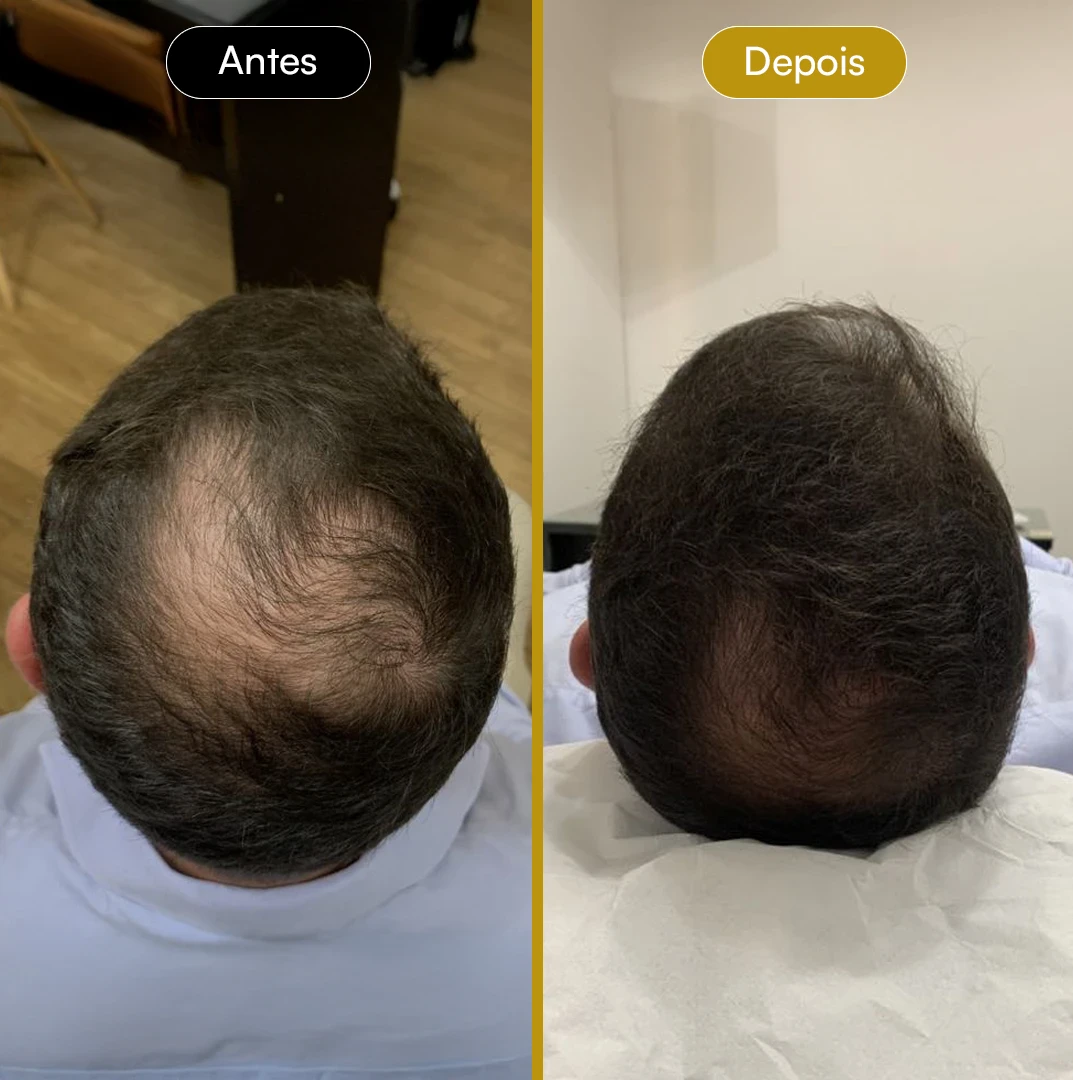 Antes e Depois 02
