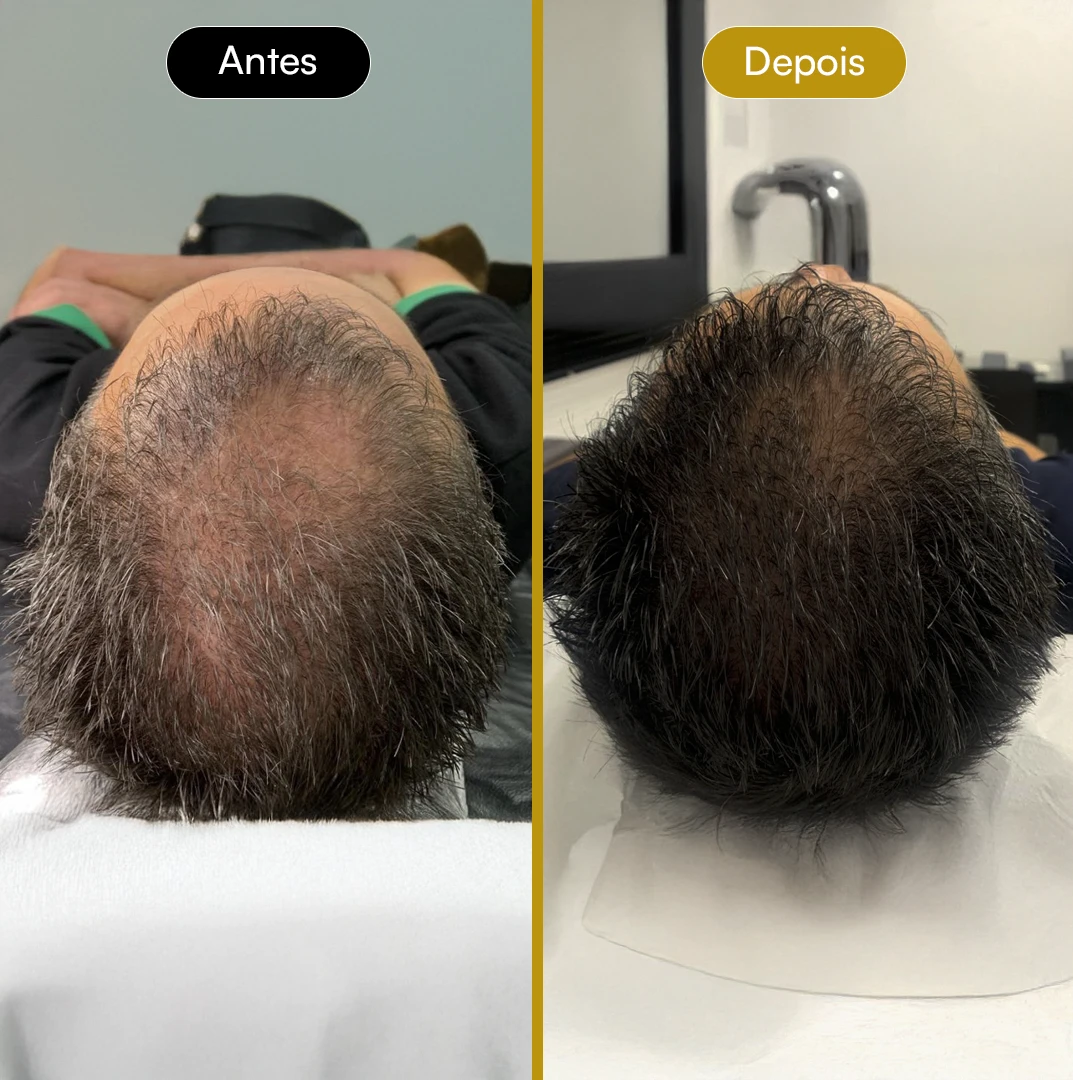Antes e Depois 04