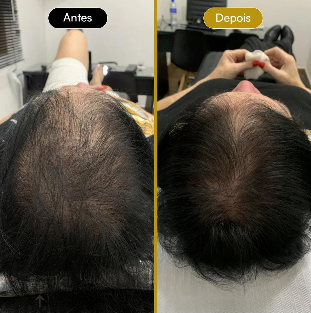 Antes e Depois 05