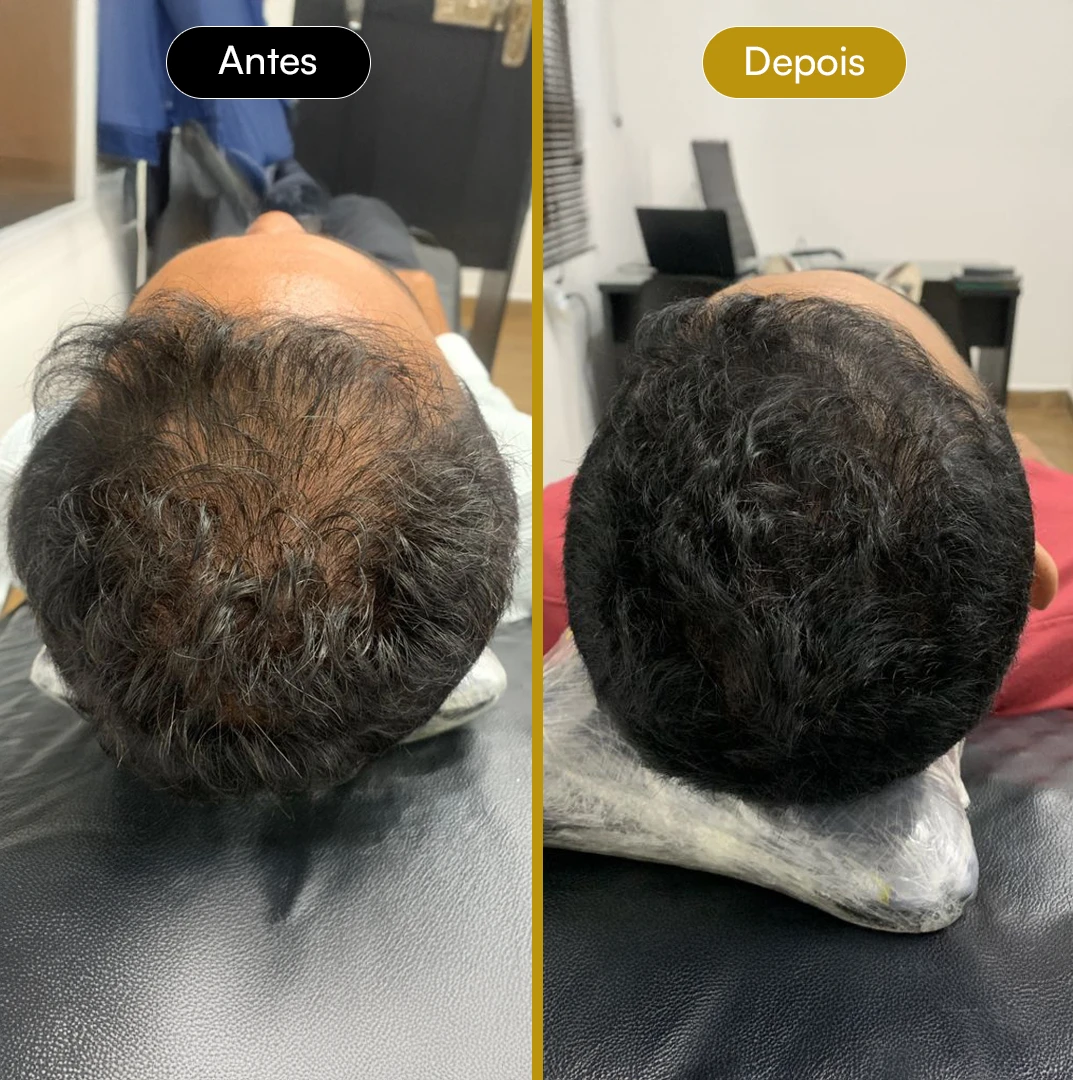 Antes e Depois 06