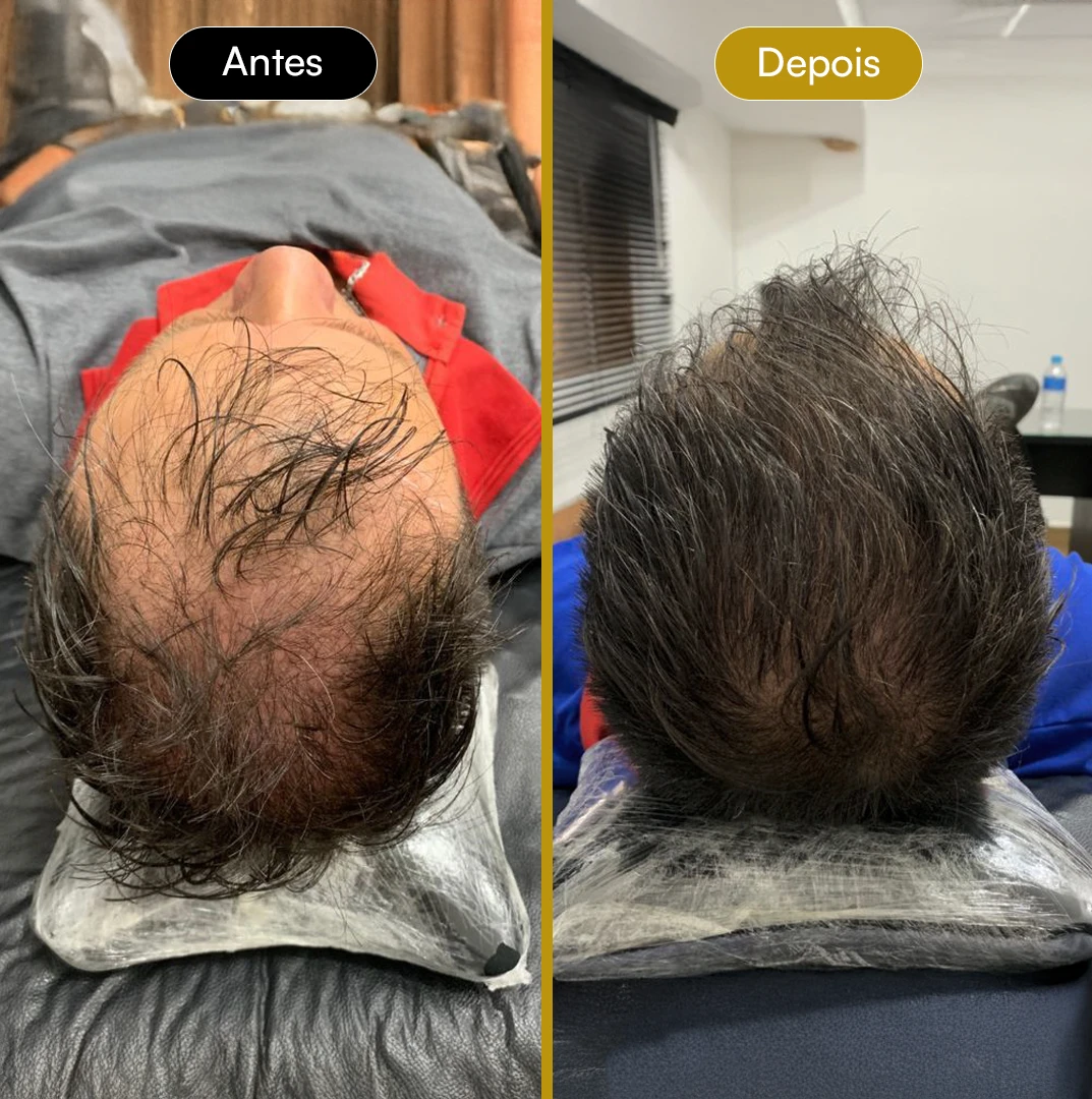 Antes e Depois 07