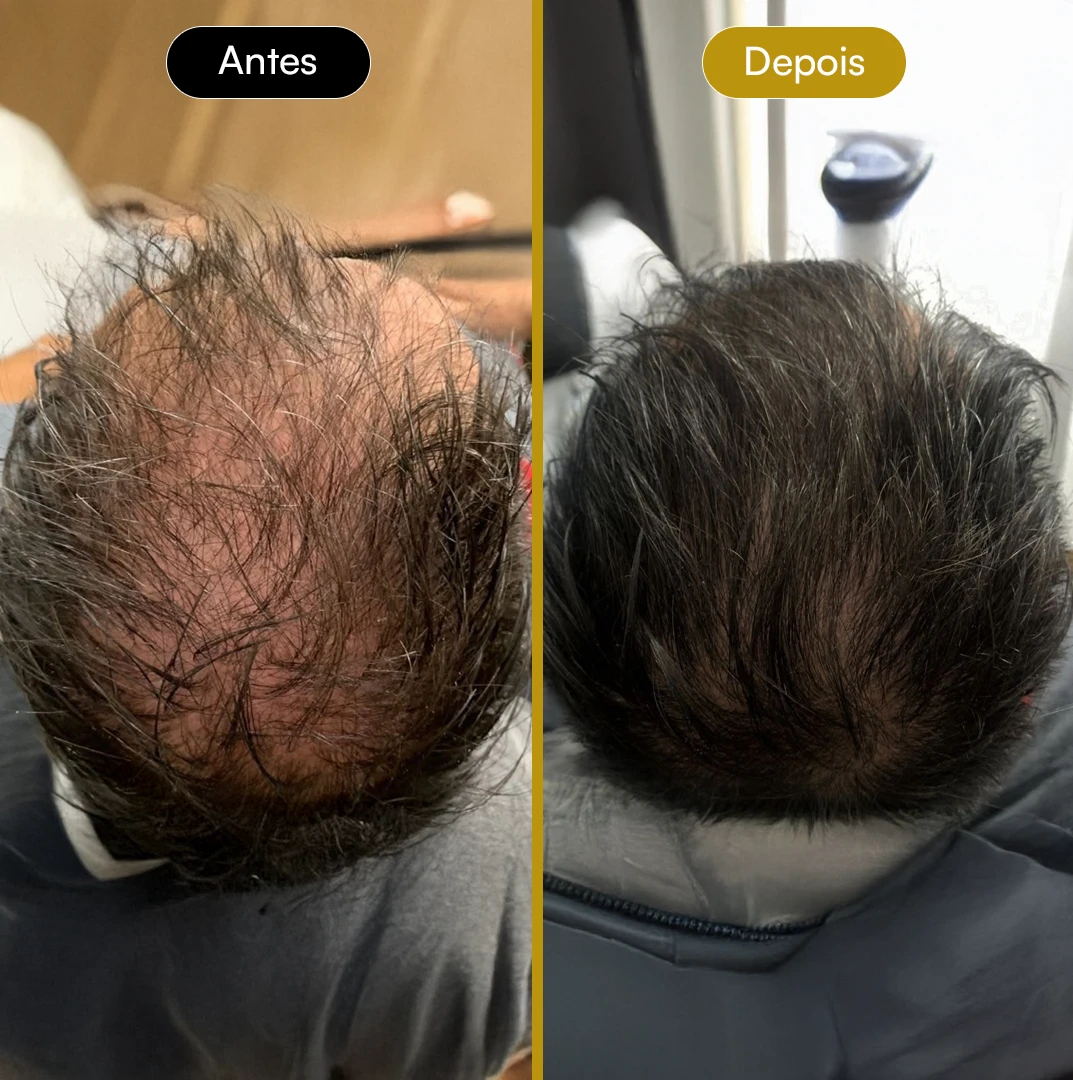 Antes e Depois 08